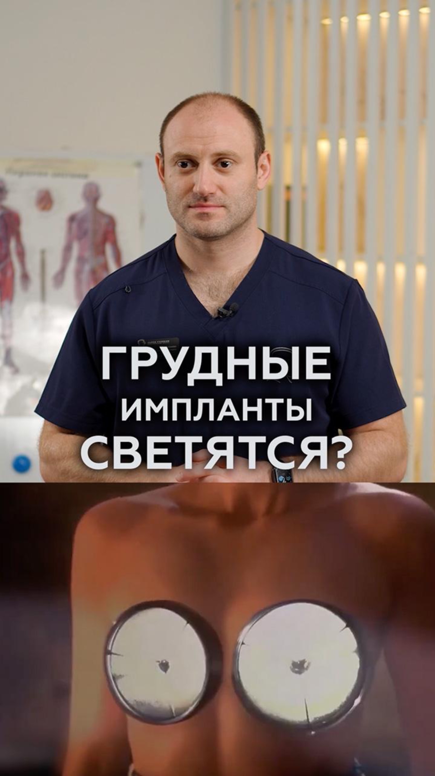 САМЫЙ НЕОБЫЧНЫЙ факт о грудных имплантах! #хирург #грудь #маммопластика