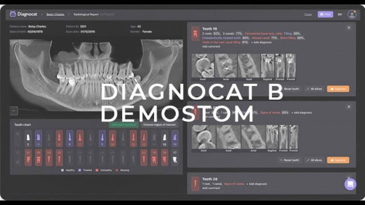 Использование искусственного интеллекта в стоматологии DemoStom