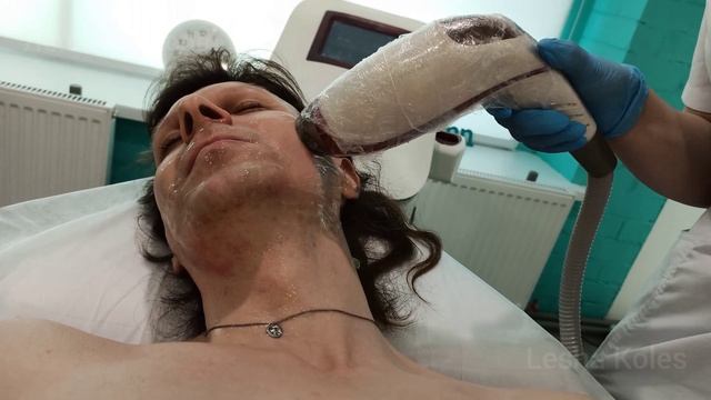 Лазерная эпиляция (Laser epilation). Лицо (Face) - 14. Глубокое бик?