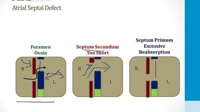Cardiology - 7. The Developing Heart - 2.Shunts atf