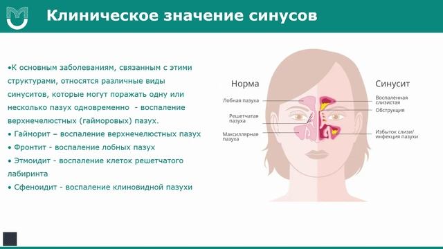 Околоносовые пазухи - строение и клиническое значение