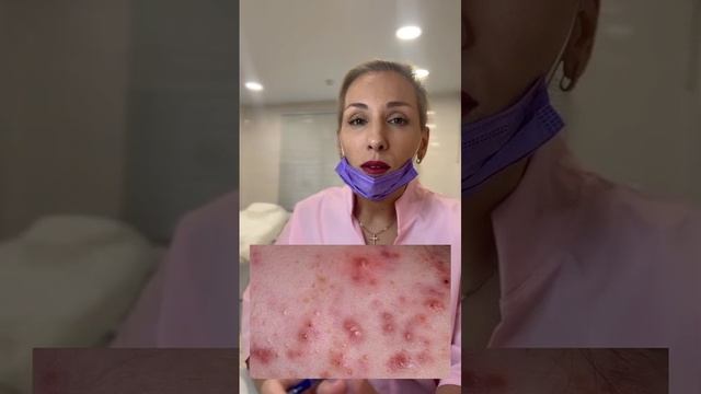 Родительские активности Уход за кожей лица