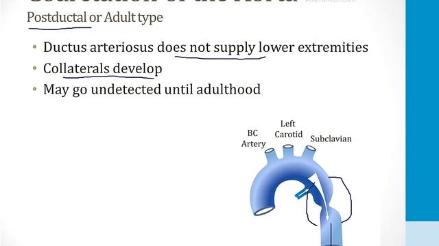 Cardiology - 7. The Developing Heart - 4.Coarctation of the Aorta atf