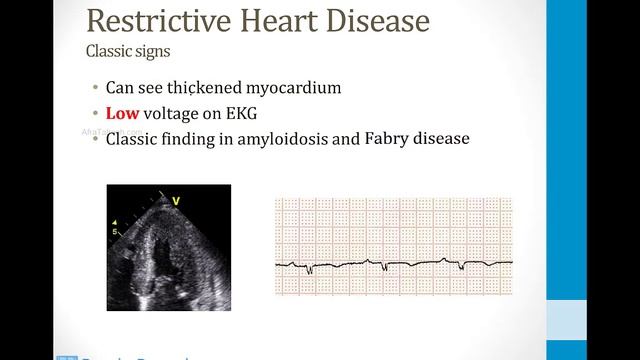 Cardiology - 6. Heart Failure - 3.Restrictive Cardiomyopathy atf