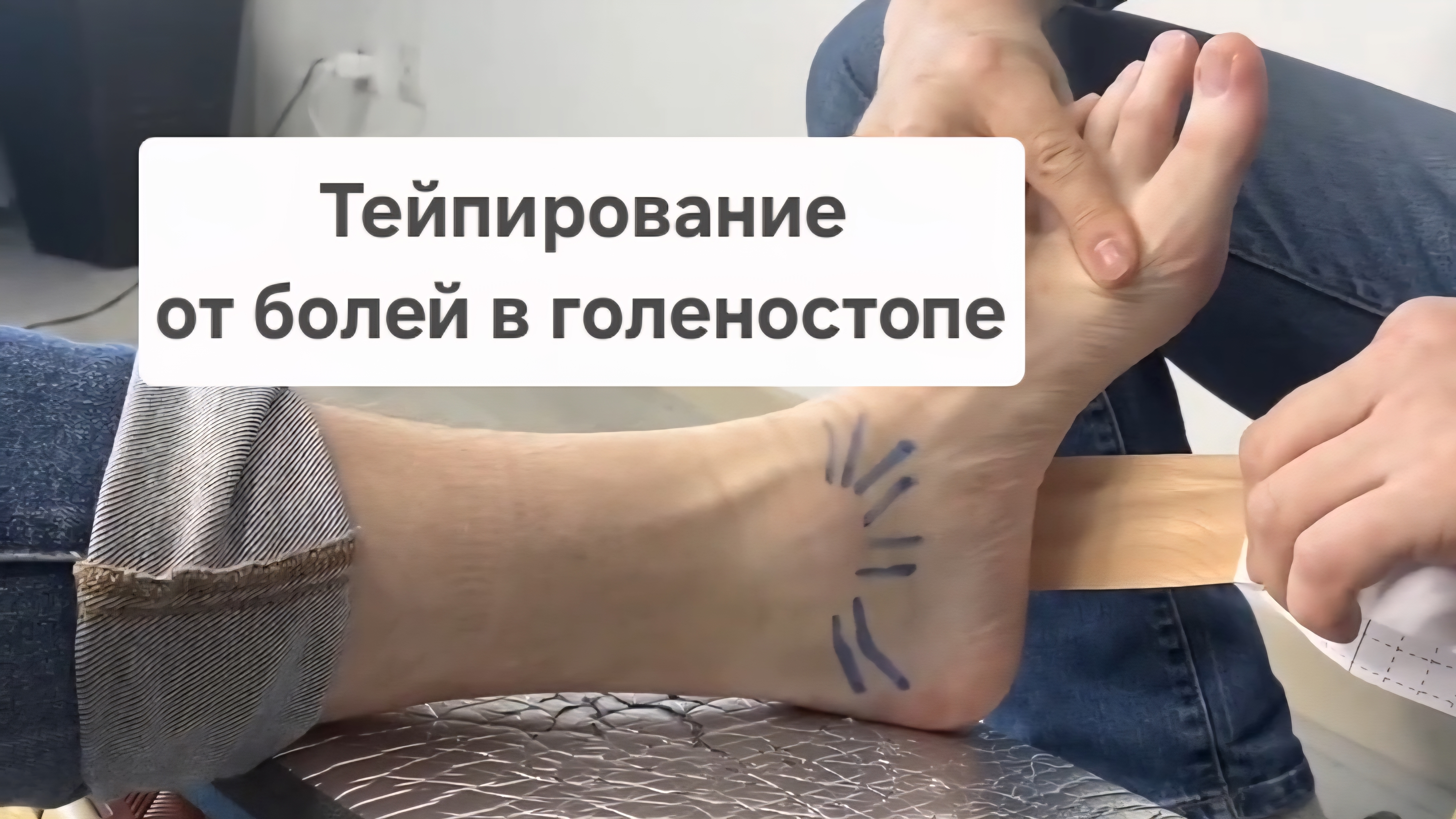 Тейпирование, от болей в голеностопе | Школа Ног