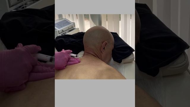 ТРИХОДИНИЯ. ВЫПАДЕНИЕ ВОЛОС. ЛЕЧЕНИЕ