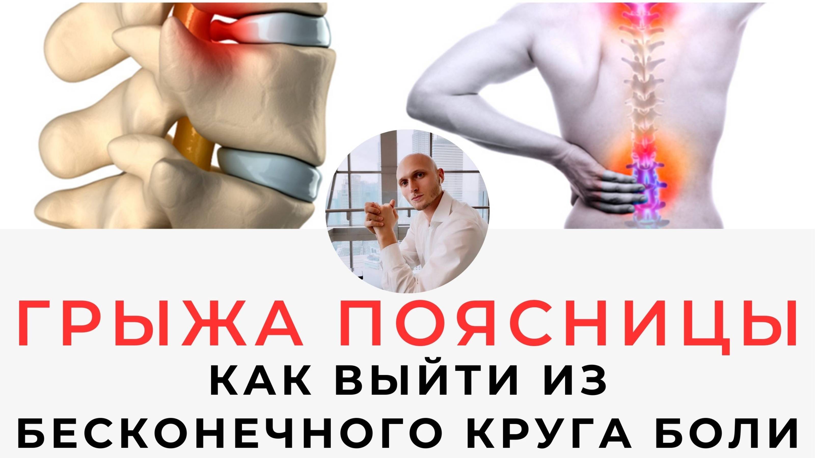 Грыжа Как выйти из бесконечного круга постоянных болей | Реабилитолог Павел Артемьев