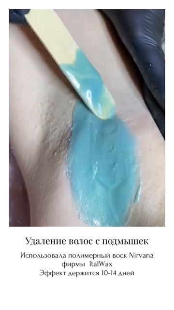 Депиляция подмышек