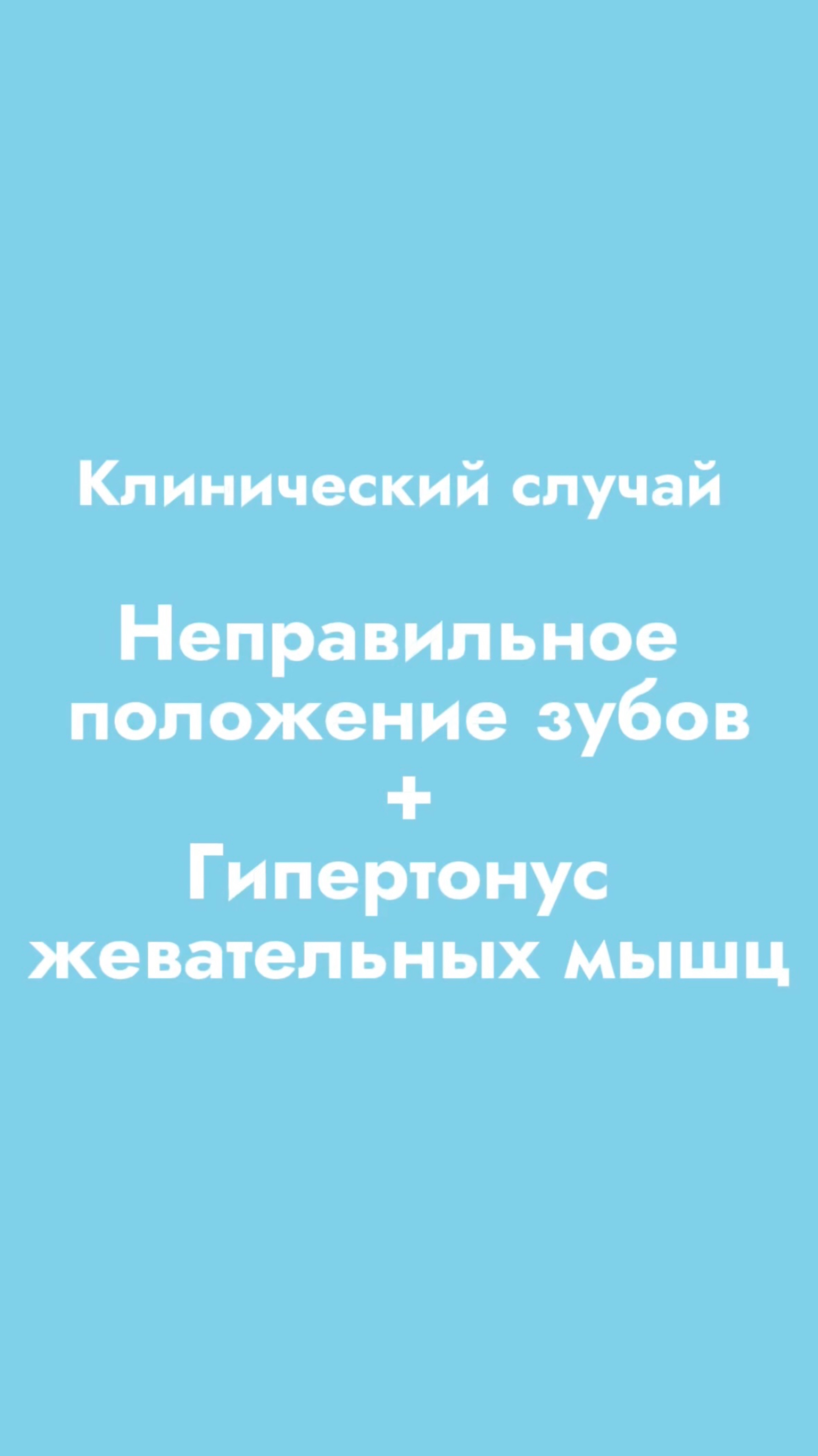Зачем нужен ГНАТОЛОГ? Клинический случай