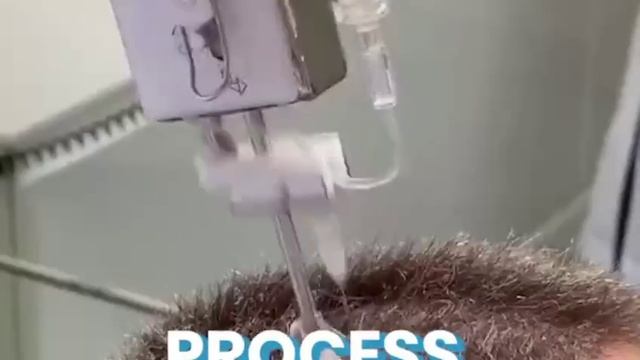 💉 Швейная машинка для волос