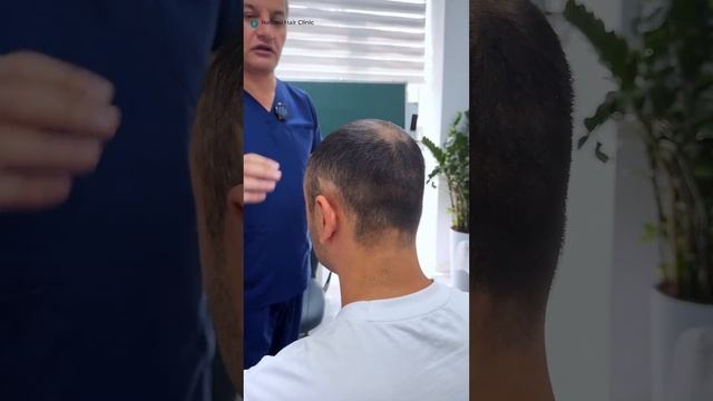 Пересадка волос и лечение очаговой алопеции #clinic #hair #tr