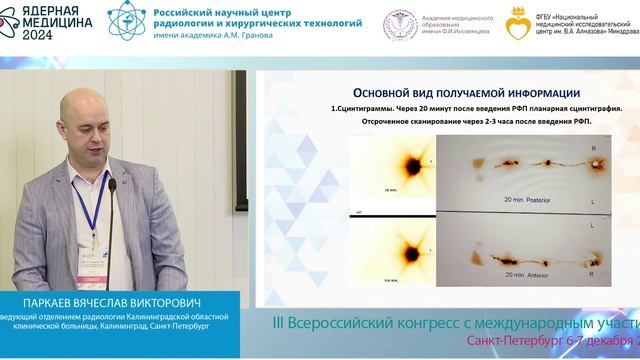 Опыт использования биопсии сторожевых лимфатических узлов (БСЛУ) при раке молочной железы и меланоме