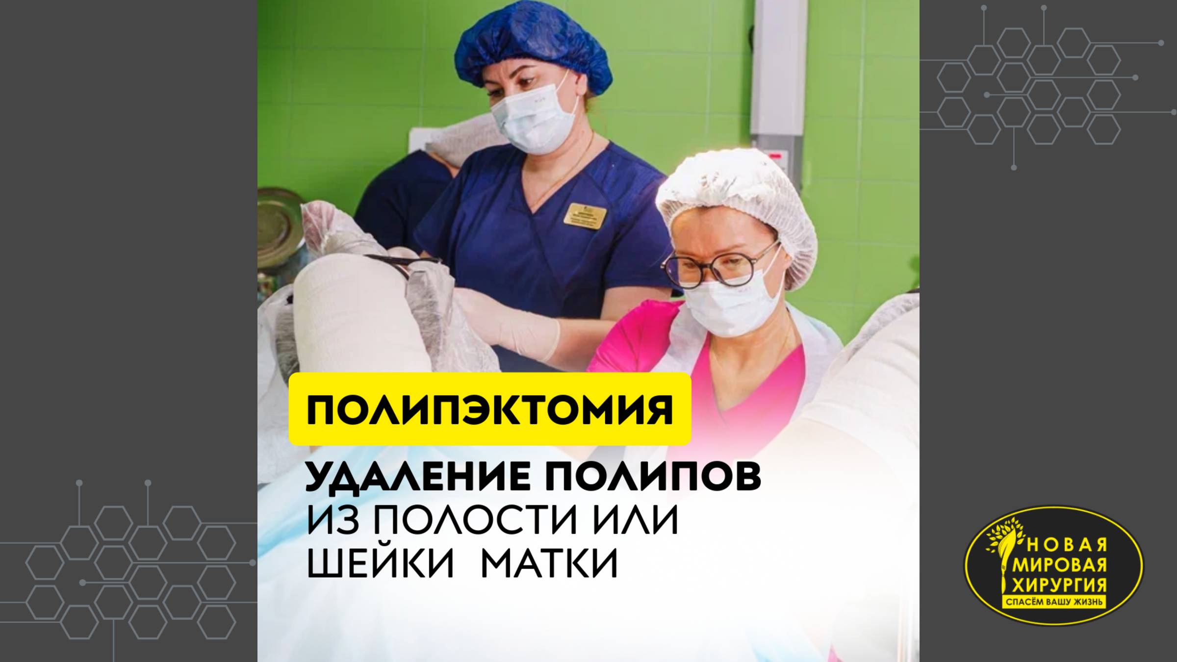 Операция по удалению полипа эндометрия (гистерорезектоскопическая полипэктомия)