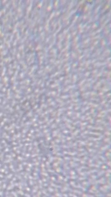 млечный сок одуванчика