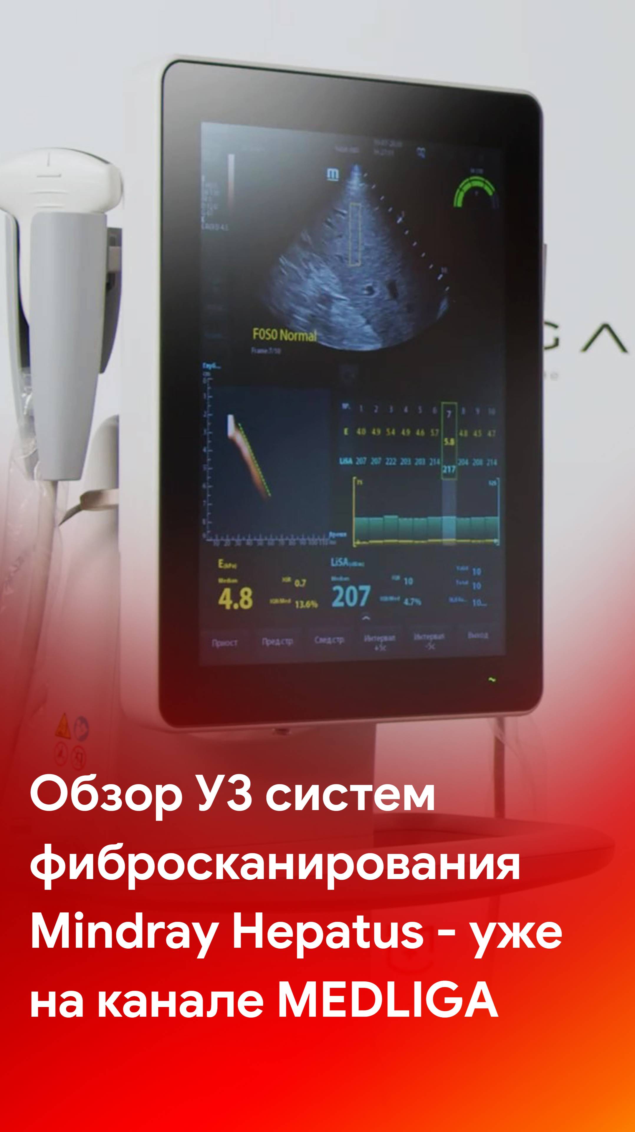 Обзор УЗ систем фибросканирования печени Mindray Hepatus