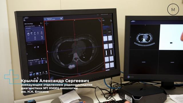 Разбор клинического случая по меланоме
