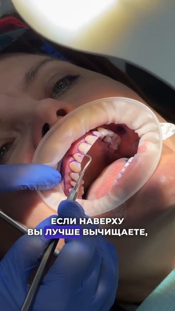 Проводим осмотр перед началом профессиональной гигиены! ❤️ Стоматология “СТОЛИЦА”  Москва