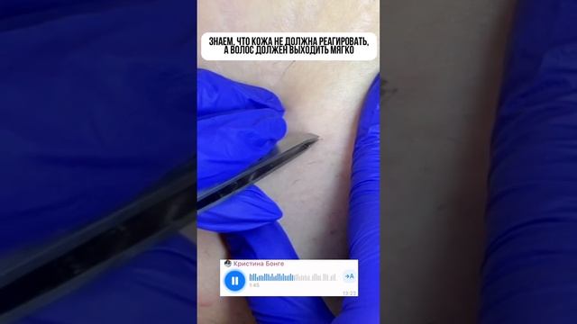 Как правильно себя оценивать мастеру электроэпиляции