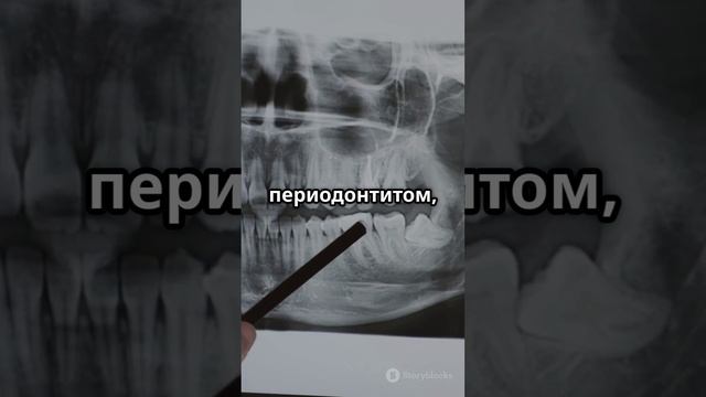 зубная боль