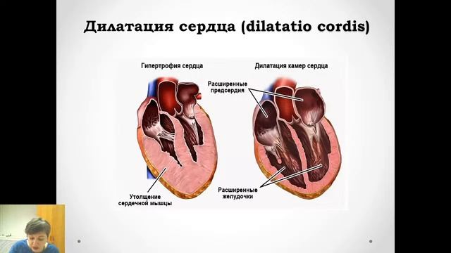II 19. Недостаточность кровообращения