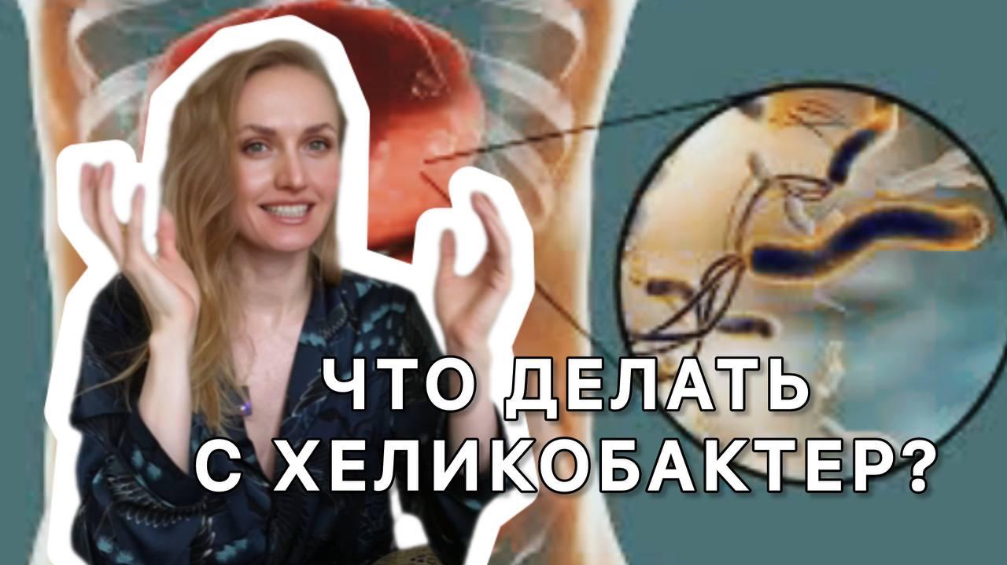 ЧТО ДЕЛАТЬ С ХЕЛИКОБАКТЕР?