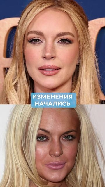Преображение Линдси Лохан — урок для КАЖДОЙ женщины! #косметология #молодость #уходзакожей