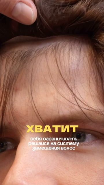Система волос