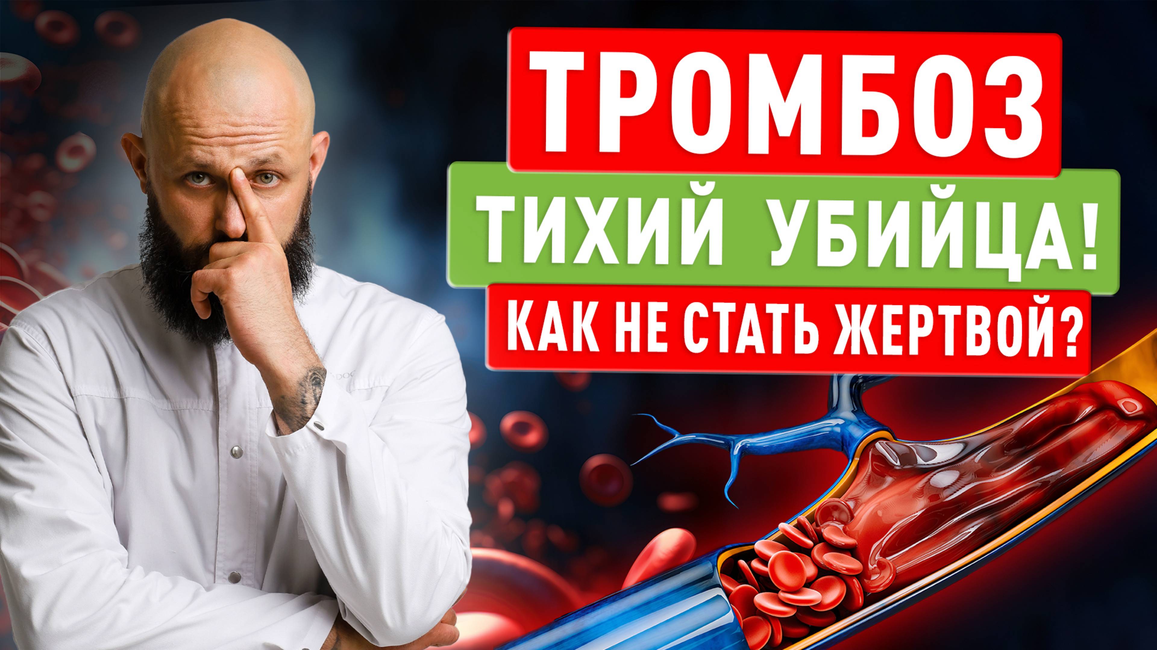 Тромбоз – тихий убийца! Как не стать жертвой?