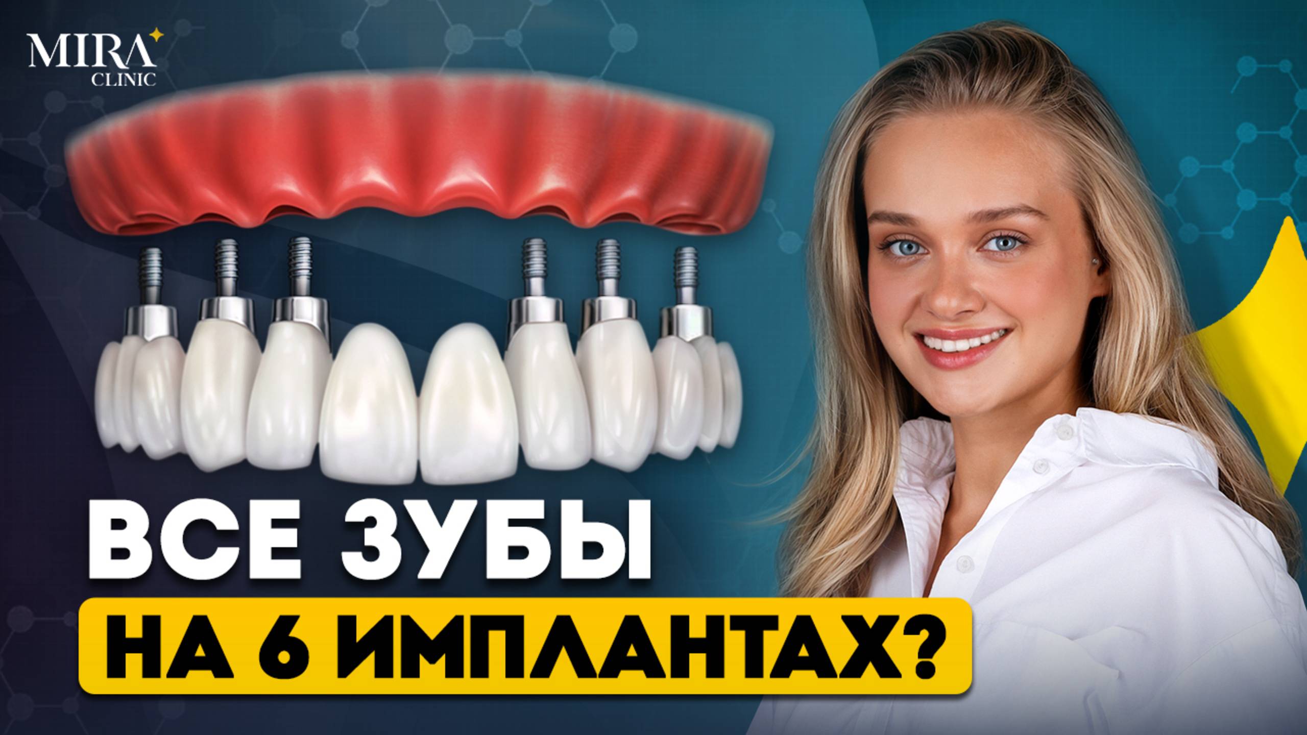 ВСЕ ЗУБЫ на 6 имплантах - All-on-6! ВСЯ ПРАВДА