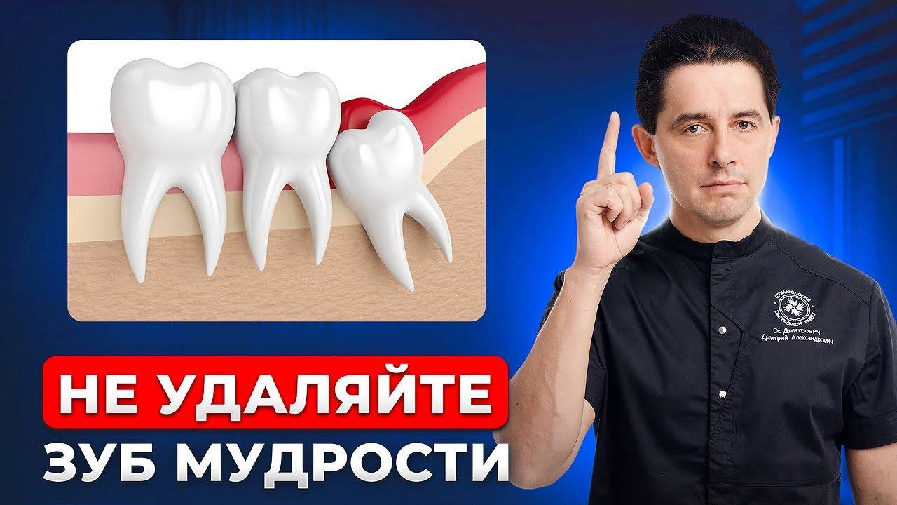 Вам не нужно удалять зуб мудрости! Хватит верить в сказки