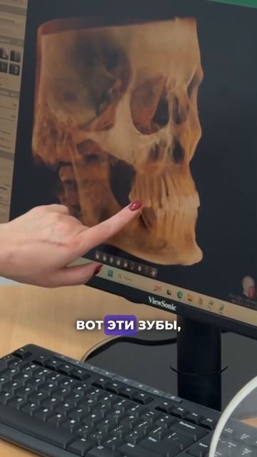 Важная часть стоматологического лечения! ❤️ Стоматология “СТОЛИЦА”  Москва, ЦАО. Круглосуточно!