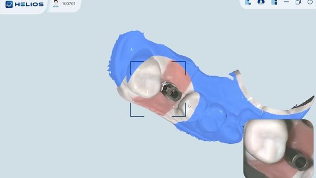 Eighteeth Helios 500: Scanning Manual for Multiple Scan Body