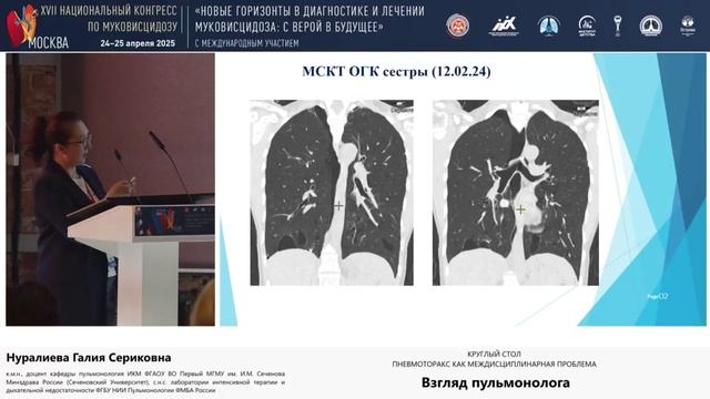 25.05, Полянка, 08:00-09:00 Пневмоторакс как междисциплинарная проблема