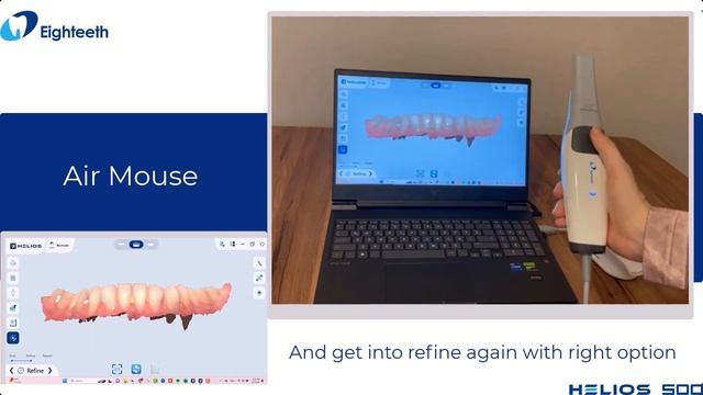 Eighteeth Helios 500： All-around Intraoral Scanner for Dentists