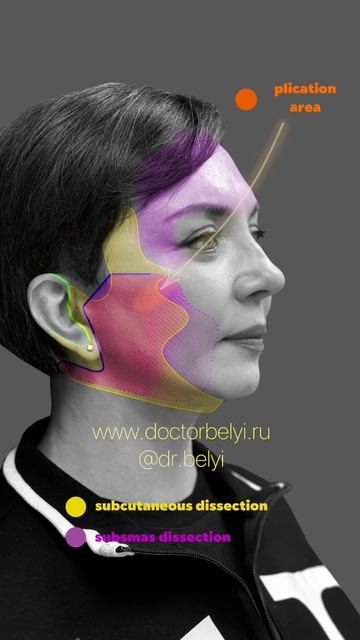 Plastic surgery #4