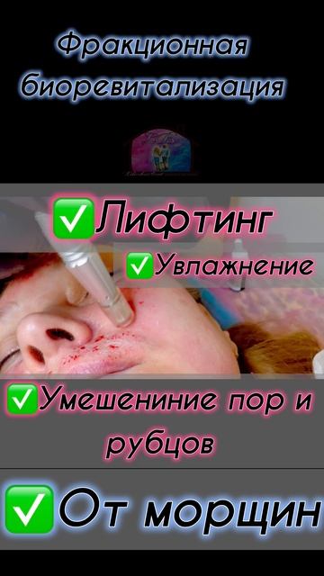 Будешь леопардиком🐆?