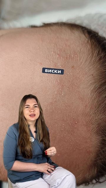 Малассезия