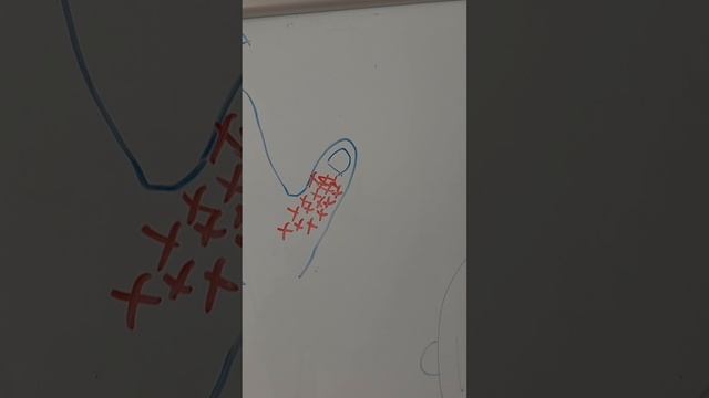 Болит шея жми это. Самый полный гайд.mp4