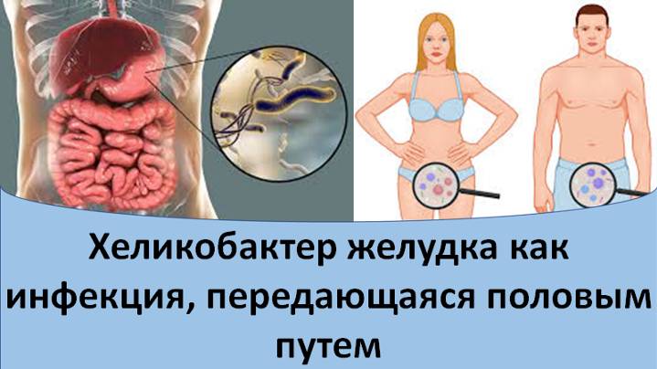 Хеликобактер как инфекция, передающаяся половым путем