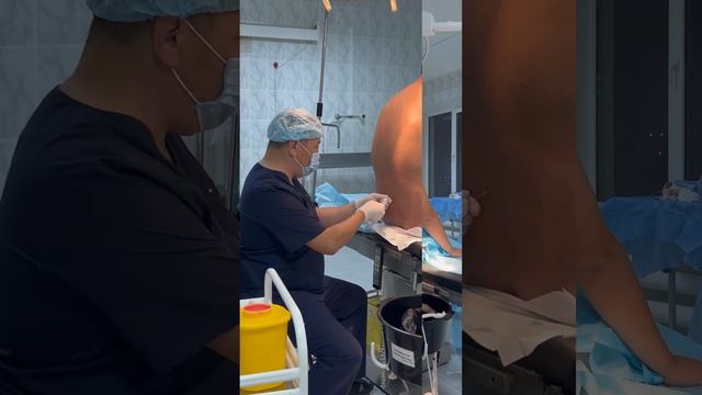 Spinal anaesthesia…Спинальная анестезия…#anestesiologia #anesthesiology #а?
