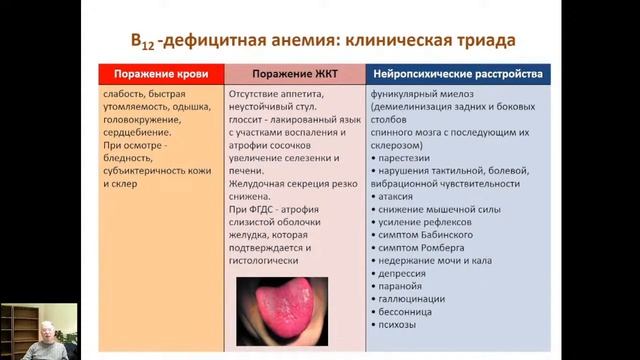 I 3. Анемии