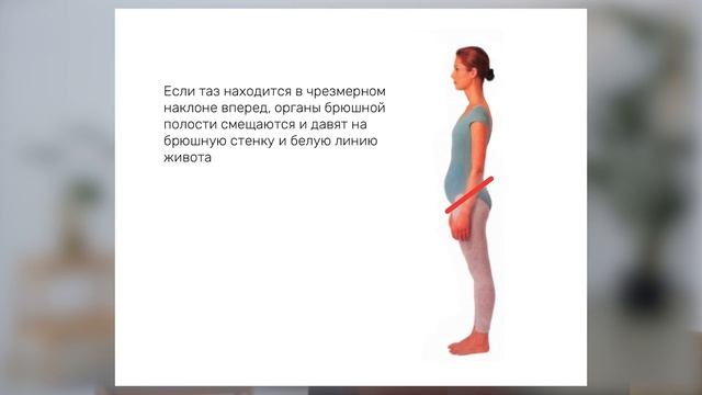 Диастаз. Как закрыть без операции?