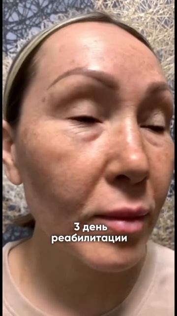 Аппарат, который творит чудеса!