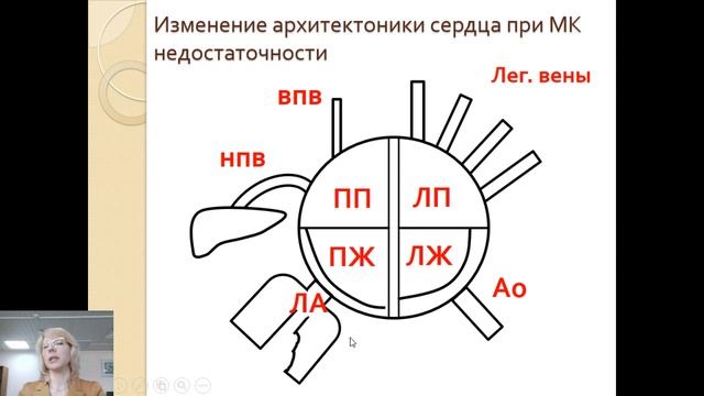 II 20. Приобретенные пороки сердца