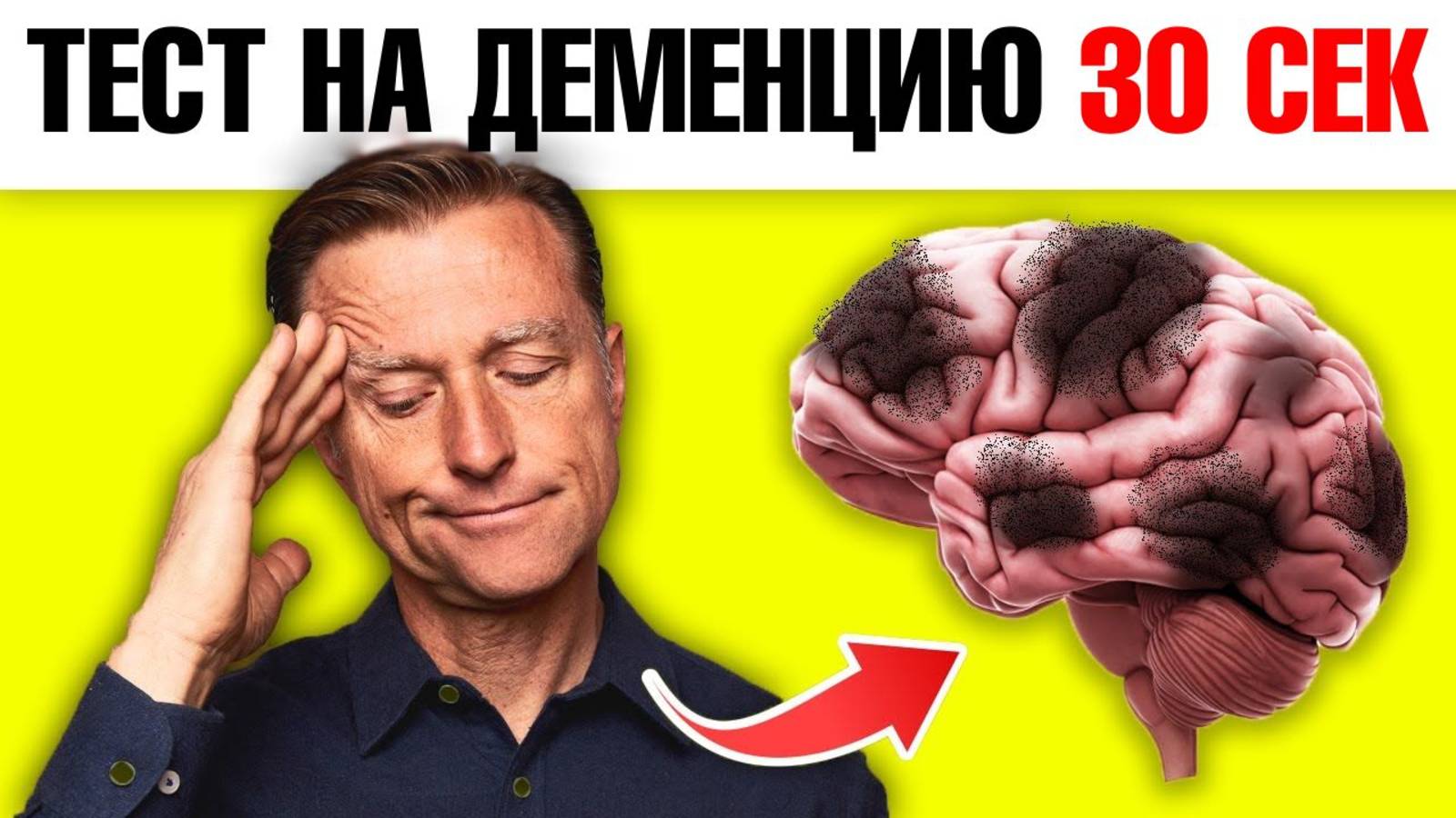 Пройдите этот тест на раннюю деменцию за 30 секунд!🔥