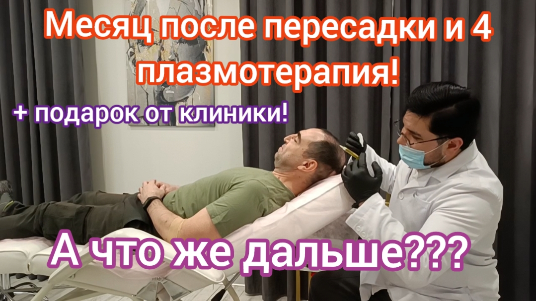 Пересадка волос. 4 плазмотерапии за первый месяц! Что дальше?