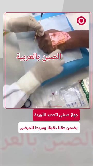 تكنولوجيا صينية جديدة متقدمة في مجال الطب