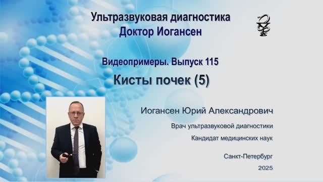 Ультразвуковая диагностика (УЗИ). Доктор Иогансен. Видеопримеры. Выпуск 115. Кисты почек (5).