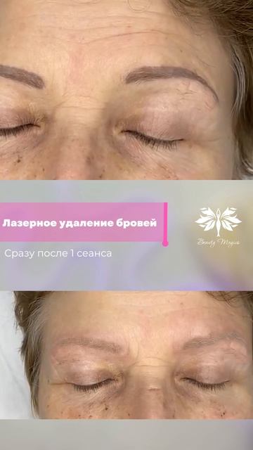 Удаление Beauty-Magics