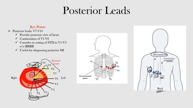 8.Posterior Leads